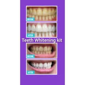 Teeth Whitening Kit in Jamaica